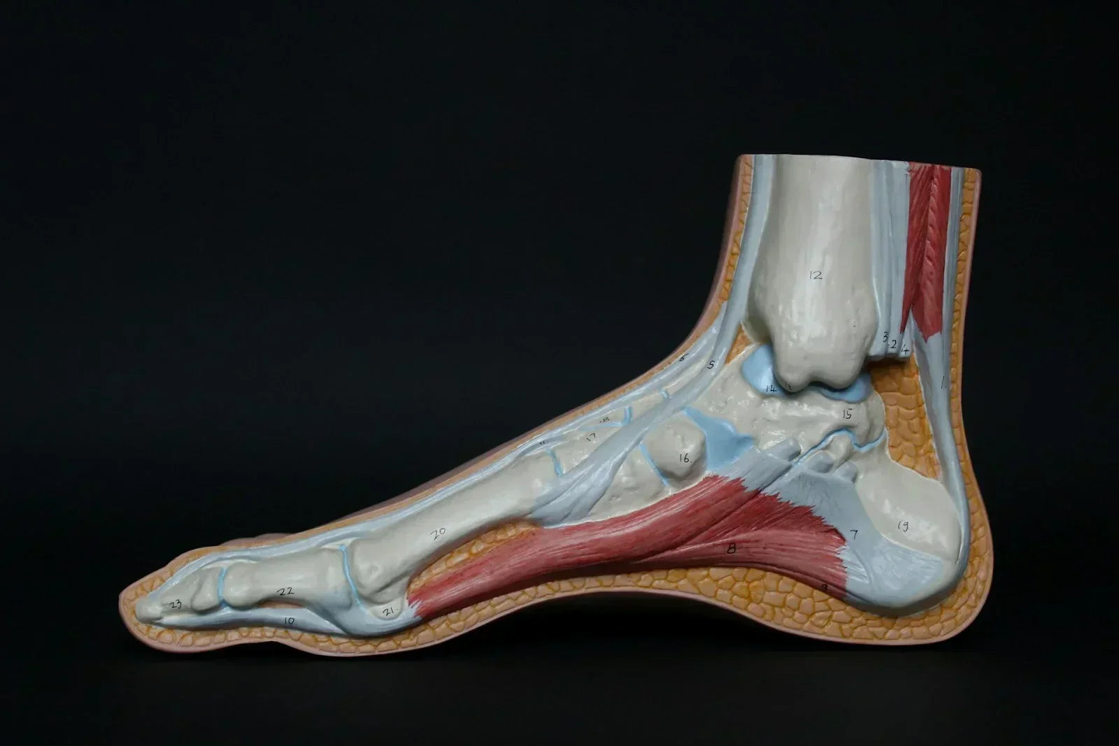 Anatomical cross-section model of the foot showing bones, plantar fascia, and heel structures commonly involved in heel spurs and chronic plantar heel pain.